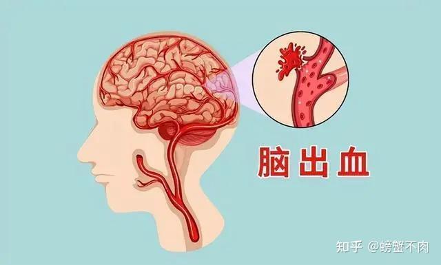 高血压的危害你注意了吗？